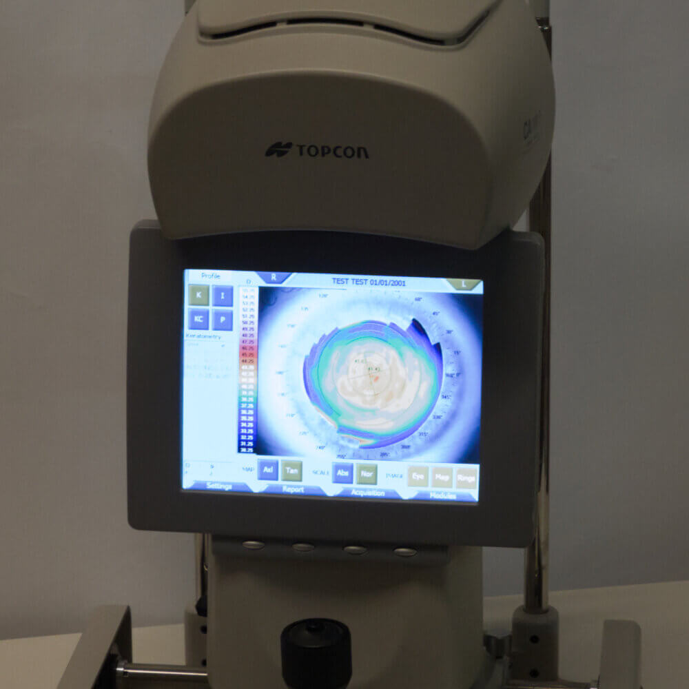 Topcon CA-200F Corneal Topographer